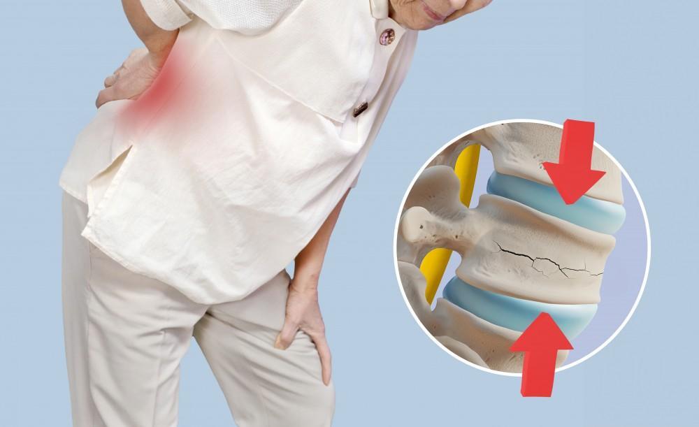 5 Daily Habits That Are Secretly Damaging Your Spine