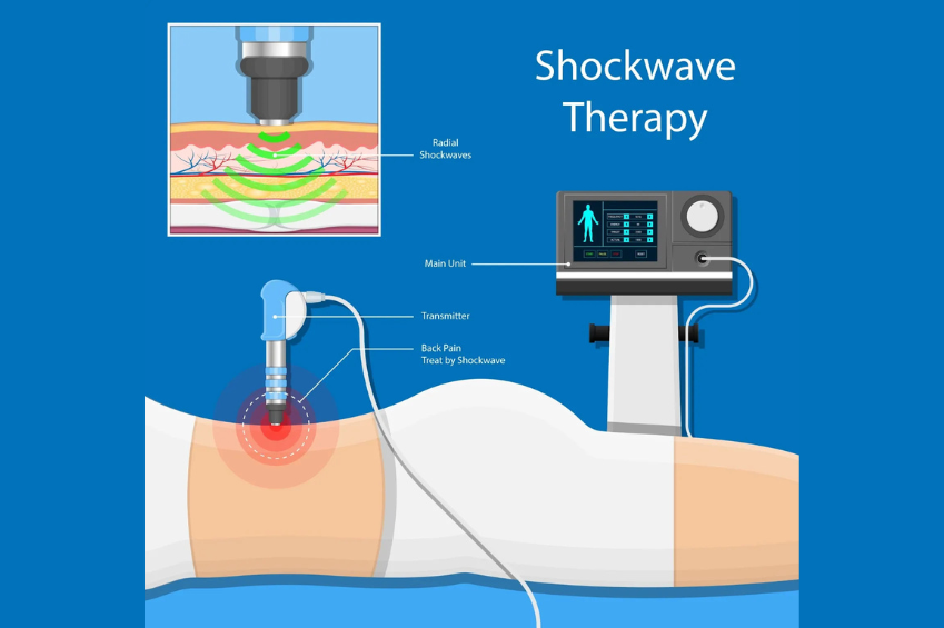 Avascular Necrosis Treatment with Super Inductive System & Focused Shockwave Therapy